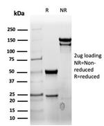 CD7 Antibody in SDS-PAGE (SDS-PAGE)