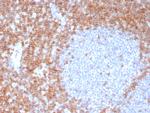 CD7 (T-Cell Leukemia Marker) Antibody in Immunohistochemistry (Paraffin) (IHC (P))