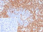 CD7 (T-Cell Leukemia Marker) Antibody in Immunohistochemistry (Paraffin) (IHC (P))