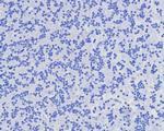 CD7 (T-Cell Leukemia Marker) Antibody in Immunohistochemistry (Paraffin) (IHC (P))