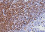 CD7 (T-Cell Leukemia Marker) Antibody in Immunohistochemistry (Paraffin) (IHC (P))