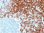 CD7 (T-Cell Leukemia Marker) Antibody in Immunohistochemistry (Paraffin) (IHC (P))