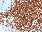 CD7 (T-Cell Leukemia Marker) Antibody in Immunohistochemistry (Paraffin) (IHC (P))