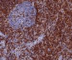 CD7 (T-Cell Leukemia Marker) Antibody in Immunohistochemistry (Paraffin) (IHC (P))