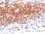 CD7 (T-Cell Leukemia Marker) Antibody in Immunohistochemistry (Paraffin) (IHC (P))
