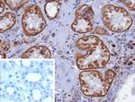 CD7 (T-Cell Leukemia Marker) Antibody in Immunohistochemistry (Paraffin) (IHC (P))