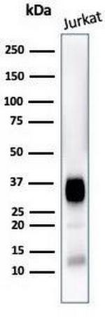 CD7 (T-Cell Leukemia Marker) Antibody in Western Blot (WB)