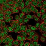 GCM2 Monoclonal Antibody (PCRP-GCM2-1B3)