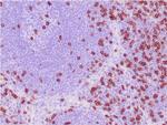 CD8A (Cytotoxic-andSuppressor T-Cell Marker) Antibody in Immunohistochemistry (Paraffin) (IHC (P))