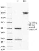 CD8A (Cytotoxic-andSuppressor T-Cell Marker) Antibody in SDS-PAGE (SDS-PAGE)