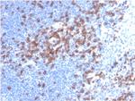 CD8A (Cytotoxic-andSuppressor T-Cell Marker) Antibody in Immunohistochemistry (Paraffin) (IHC (P))
