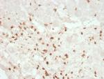 CD8A (Cytotoxic- and Suppressor T-Cell Marker) Antibody in Immunohistochemistry (Paraffin) (IHC (P))