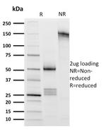 CD8A (Cytotoxic- and Suppressor T-Cell Marker) Antibody in SDS-PAGE (SDS-PAGE)