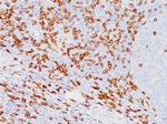 CD8a (Cytotoxic-andSuppressor T-Cell Marker) Antibody in Immunohistochemistry (Paraffin) (IHC (P))