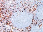 CD8A (Cytotoxic/Suppressor T-Cell Marker) Antibody in Immunohistochemistry (Paraffin) (IHC (P))