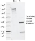 CD8A (Cytotoxic/Suppressor T-Cell Marker) Antibody in SDS-PAGE (SDS-PAGE)