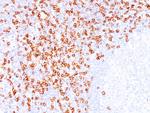 CD8A (Cytotoxic/Suppressor T-Cell Marker) Antibody in Immunohistochemistry (Paraffin) (IHC (P))