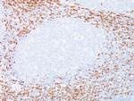 CD8A (Cytotoxic- and Suppressor T-Cell Marker) Antibody in Immunohistochemistry (Paraffin) (IHC (P))