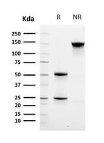 CD8A (Cytotoxic- and Suppressor T-Cell Marker) Antibody in SDS-PAGE (SDS-PAGE)