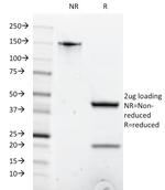 CD8A (Cytotoxic/Suppressor T-Cell Marker) Antibody in SDS-PAGE (SDS-PAGE)