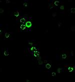 CD8A (Cytotoxic/Suppressor T-Cell Marker) Antibody in Immunocytochemistry (ICC/IF)