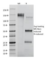 CD8A (Cytotoxic/Suppressor T-Cell Marker) Antibody in SDS-PAGE (SDS-PAGE)
