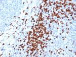 CD8A Antibody in Immunohistochemistry (Paraffin) (IHC (P))