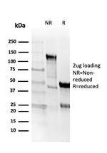 CD8A Antibody in SDS-PAGE (SDS-PAGE)