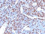 CD8A Antibody in Immunohistochemistry (Paraffin) (IHC (P))