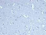 CD8A Recombinant Rabbit Monoclonal Antibody (CD8, 4391R)