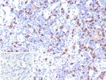 CD8A (Cytotoxic/Suppressor T-Cell Marker) Antibody in Immunohistochemistry (Paraffin) (IHC (P))