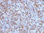 CD8A (Cytotoxic- and Suppressor T-Cell Marker) Antibody in Immunohistochemistry (Paraffin) (IHC (P))