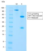 CD8A (Cytotoxic- and Suppressor T-Cell Marker) Antibody in SDS-PAGE (SDS-PAGE)