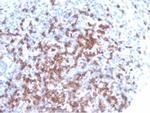 CD8A (Cytotoxic- and Suppressor T-Cell Marker) Antibody in Immunohistochemistry (Paraffin) (IHC (P))