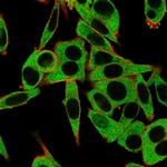 RPS6KA5/MSK1 Monoclonal Antibody (PCRP-RPS6KA5-1A8)