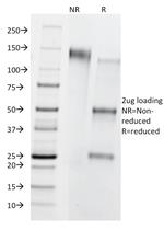 CD8B (Cytotoxic/Suppressor T-Cell Marker) Antibody in SDS-PAGE (SDS-PAGE)