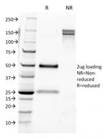 CD9 (TSPAN29) (Motility-Related Protein-1) Antibody in SDS-PAGE (SDS-PAGE)