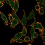 ZNF276 (Transcription Factor) Antibody in Immunocytochemistry (ICC/IF)