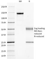 CD14 (Monocyte/Macrophage Marker) Antibody in SDS-PAGE (SDS-PAGE)