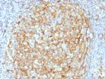 CD14 Antibody in Immunohistochemistry (Paraffin) (IHC (P))