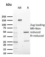 CD14 Antibody in SDS-PAGE (SDS-PAGE)