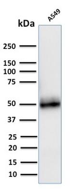 CD14 Antibody in Western Blot (WB)