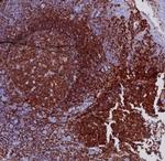 CD19 (B-Lymphocyte Marker) Antibody in Immunohistochemistry (Paraffin) (IHC (P))