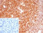 CD19 (B-Lymphocyte Marker) Antibody in Immunohistochemistry (Paraffin) (IHC (P))