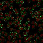 CD19 (B-Lymphocyte Marker) Antibody in Immunocytochemistry (ICC/IF)