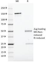 CD19 (B-Lymphocyte Marker) Antibody in SDS-PAGE (SDS-PAGE)