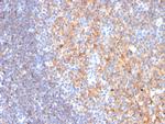 CD19 (B-Lymphocyte Marker) Antibody in Immunohistochemistry (Paraffin) (IHC (P))