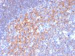 CD19 (B-Lymphocyte Marker) Antibody in Immunohistochemistry (Paraffin) (IHC (P))