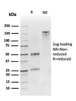CD19 (B-Lymphocyte Marker) Antibody in SDS-PAGE (SDS-PAGE)