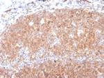 CD19 (B-Lymphocyte Marker) Antibody in Immunohistochemistry (Paraffin) (IHC (P))